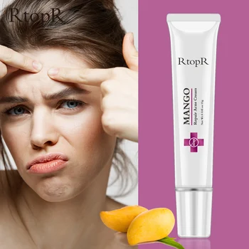 RtopR Mango Repair Acne Cream Anti Acne Spots Acne Treatment Scar Blackhead Cream Shrink Pores Wybielanie Krem Do Pielęgnacji Skóry